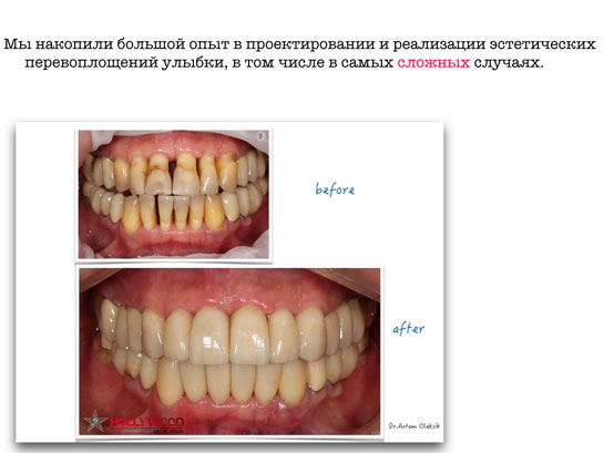 Большой опыт в сложных случаях